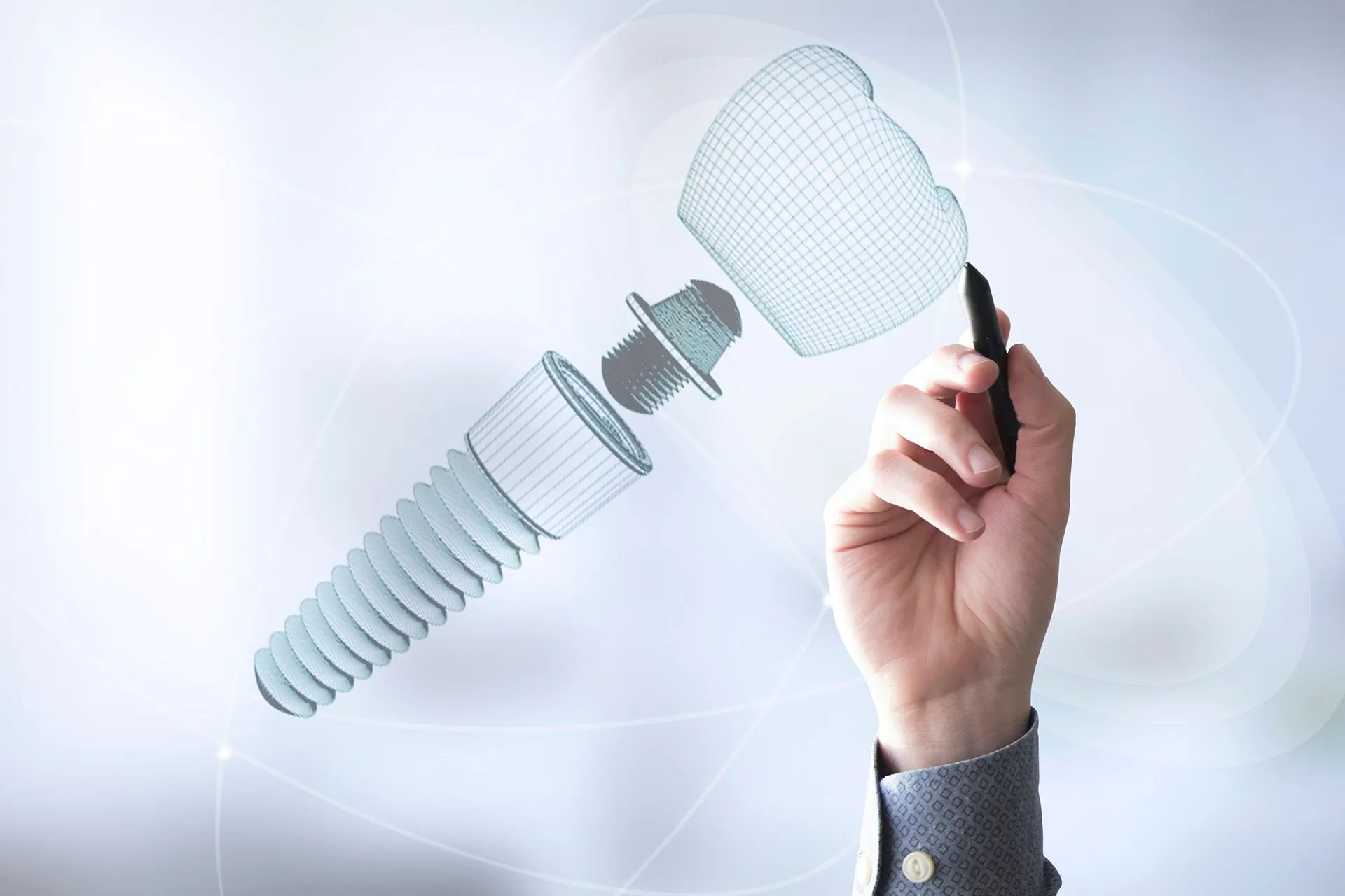 What Are Dental Implants Made Of?