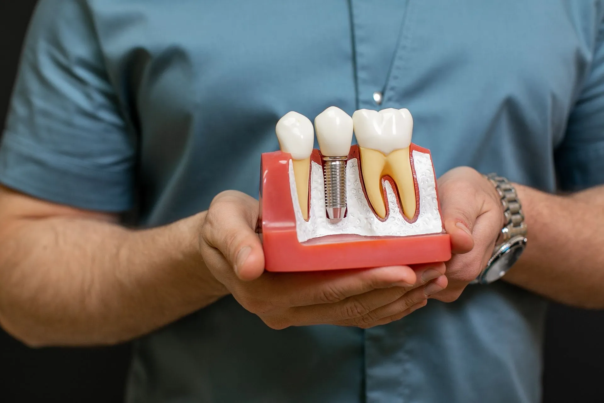 Understanding the Differences Between Mini Implants and Traditional Implants