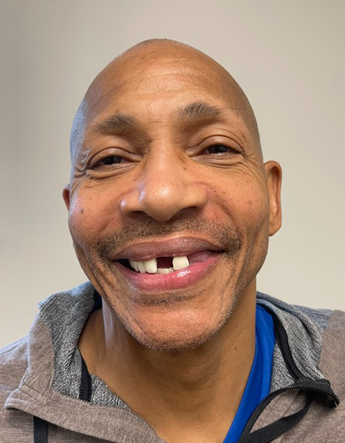 SmileHaus_Patient_02_Before-48eb42b5-7b3040ea-6b717456-1920w