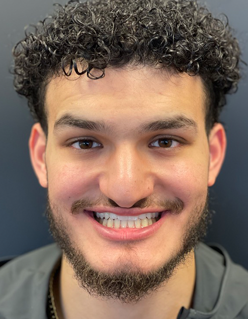 SmileHaus_Patient_03_After-68691b12-05508356-1920w