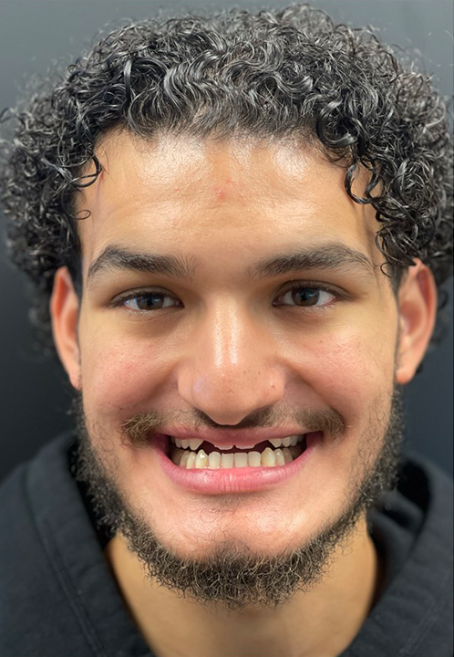 SmileHaus_Patient_03_Before-1920w
