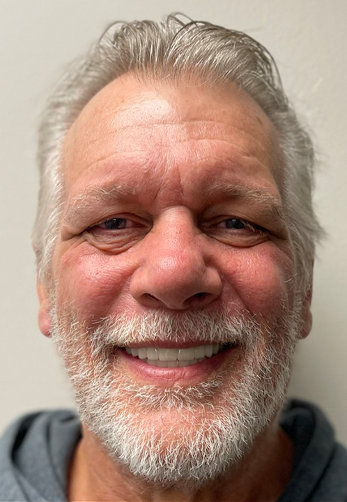 SmileHaus_Patient_04_After-1920w