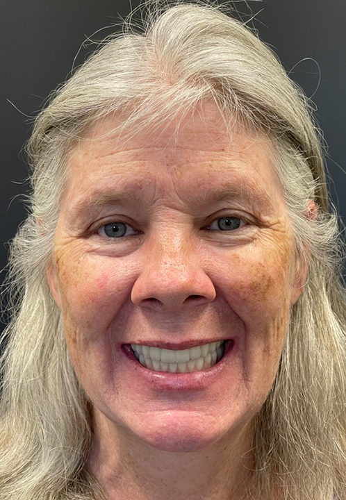 SmileHaus_Patient_06_After-1920w