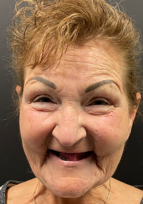 SmileHaus_Patient_09_Before-6b0d6bae-1920w