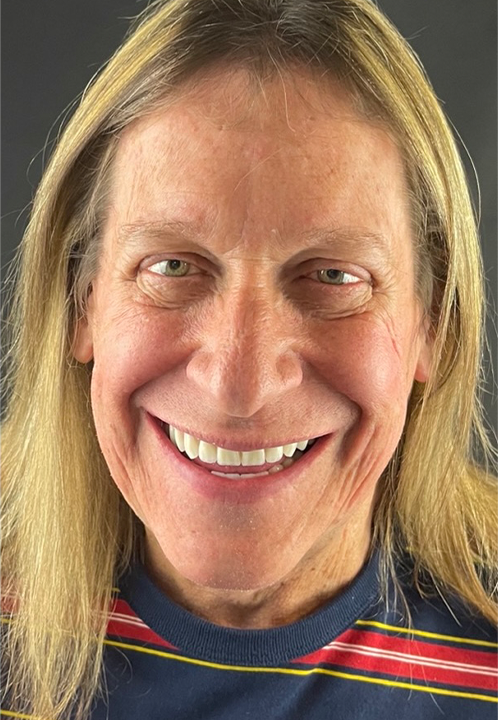 SmileHaus_Patient_12_After-1920w