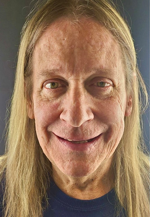 SmileHaus_Patient_12_Before-1920w