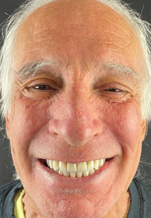 SmileHaus_Patient_14_After-1920w