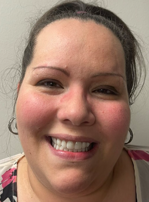 SmileHaus_Patient_15_After-e88a7546-45a00cc8-1920w