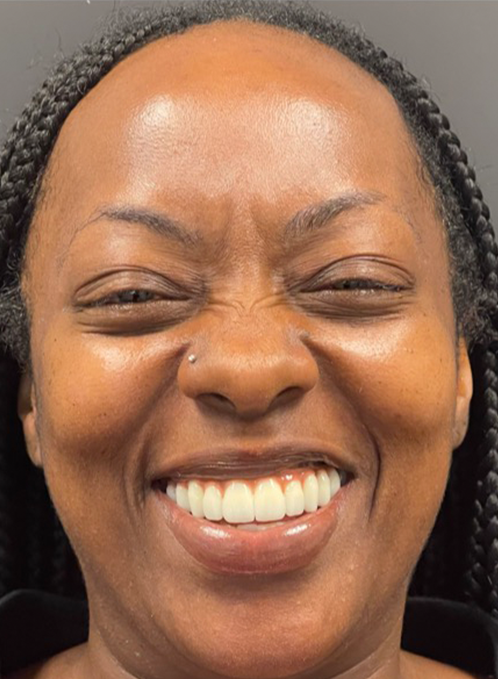 SmileHaus_Patient_16_After-a68d5162-1920w