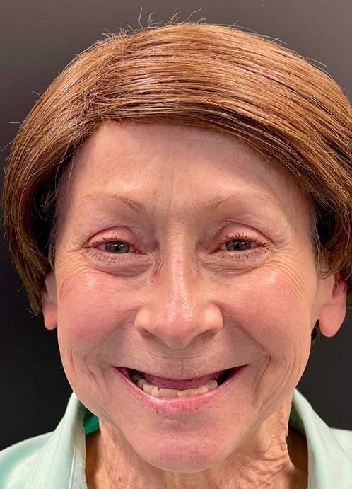 SmileHaus_Patient_17_Before-61879774-eb6edd37-1920w