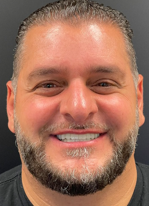 SmileHaus_Patient_18_After-2479c2da-1920w