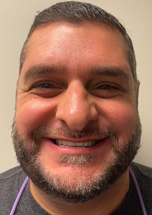 SmileHaus_Patient_18_Before-5af4f4b6-1920w