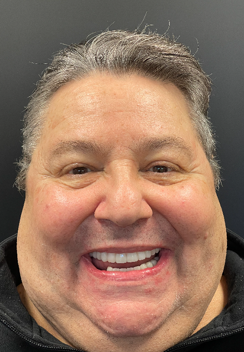 SmileHaus_Patient_19_After-1920w