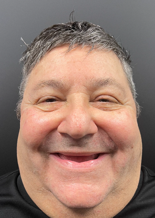 SmileHaus_Patient_19_Before-34c2ef1c-1920w